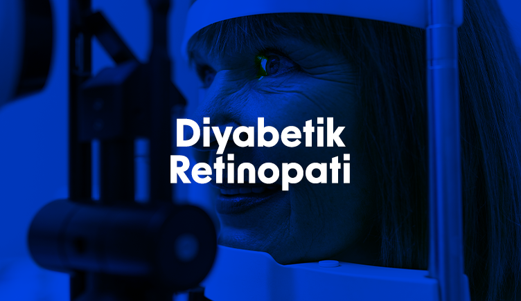 Diyabetik Retinopati